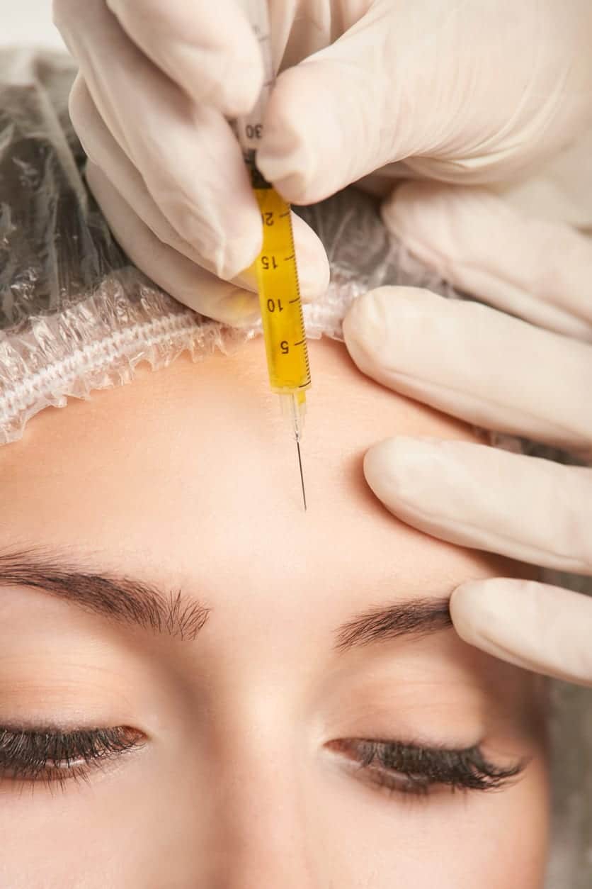 PRP-behandling (Platelet-Rich Plasma)