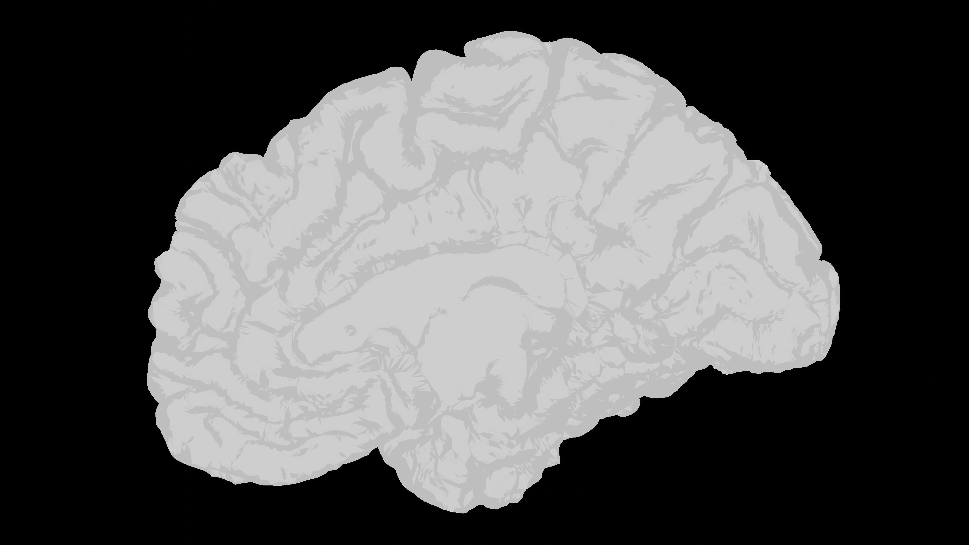 Why Normal Brain Scans Miss Chronic Migraines