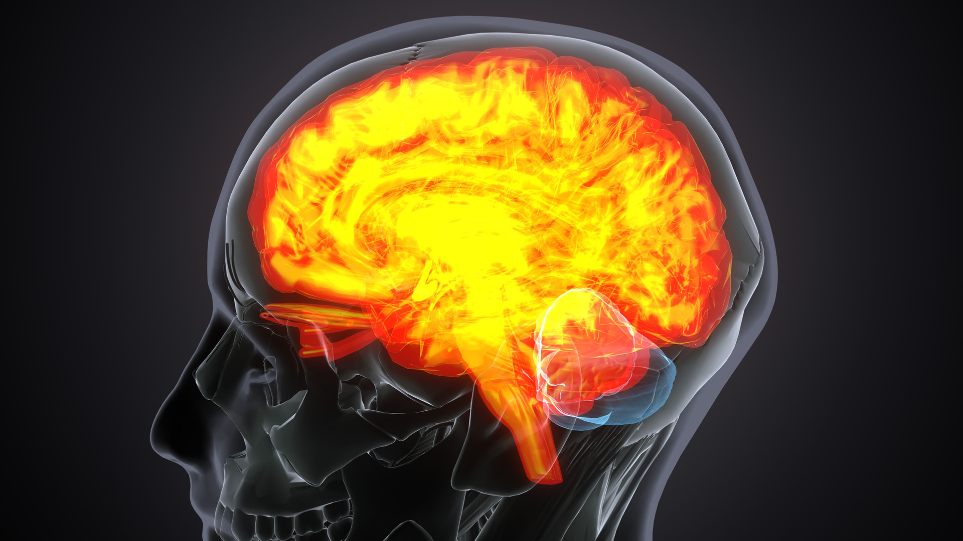 Hidden Encephalitis: What It Is and Why It’s More Common Than You Know