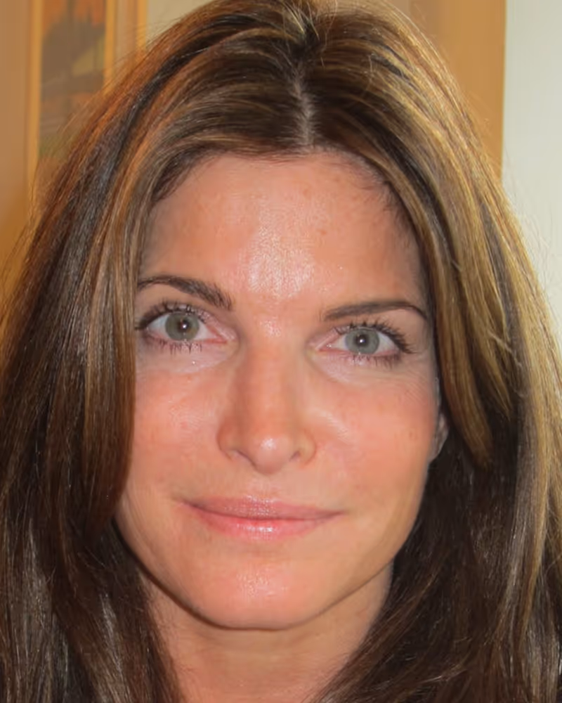 Well-known model and actress—patient.