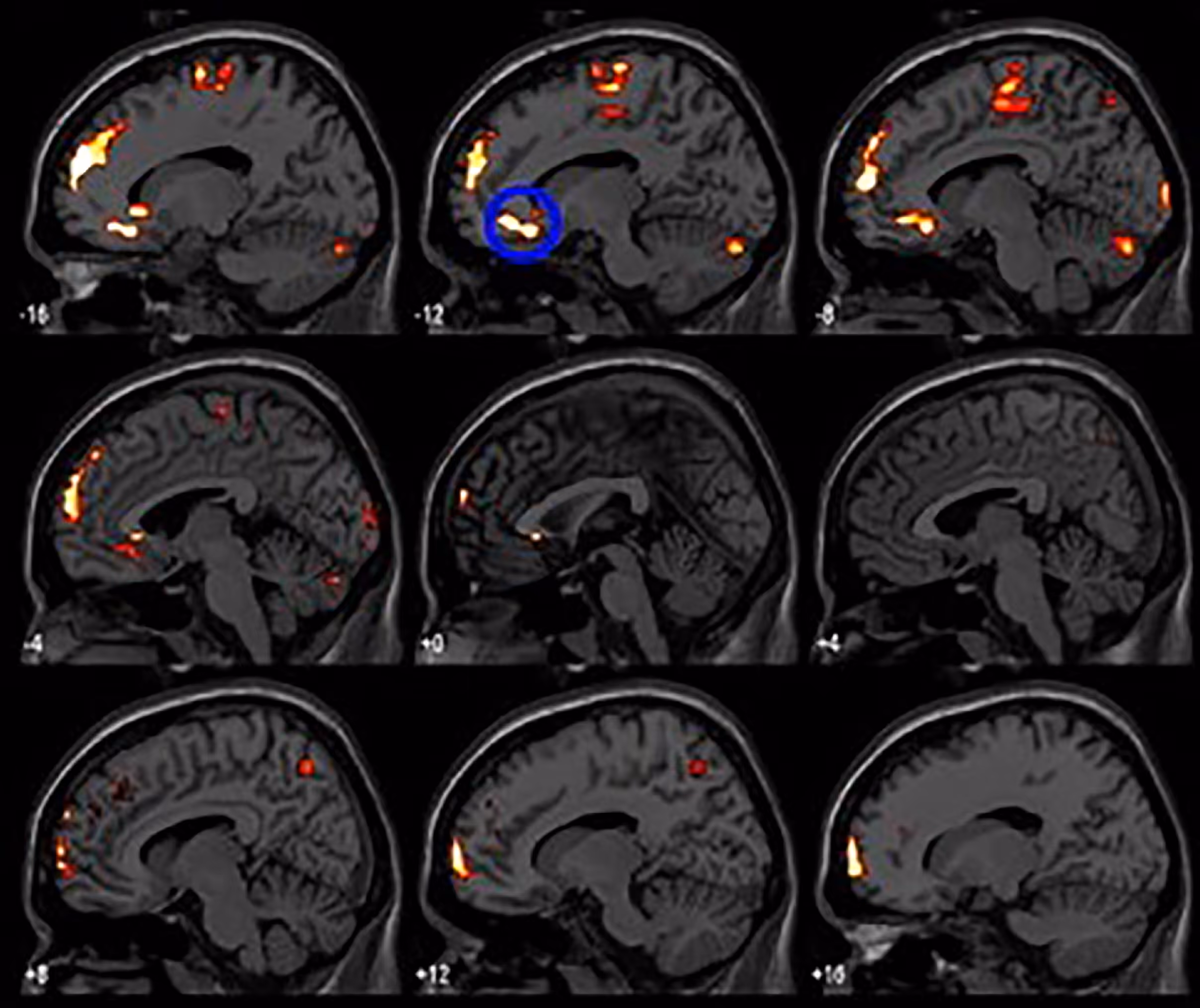 Patient consultation at the New York Headache Center.
