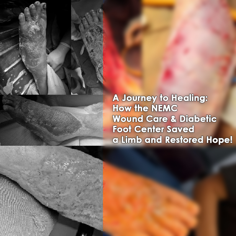 A Journey to Healing: How the NEMC Wound Care & Diabetic Foot Center Saved a Limb and Restored Hope!