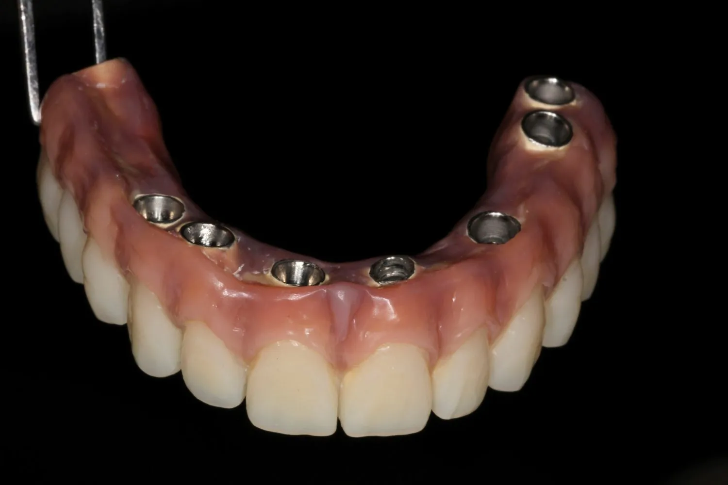 All on 4 – Maida Smiles Dental Clinic
