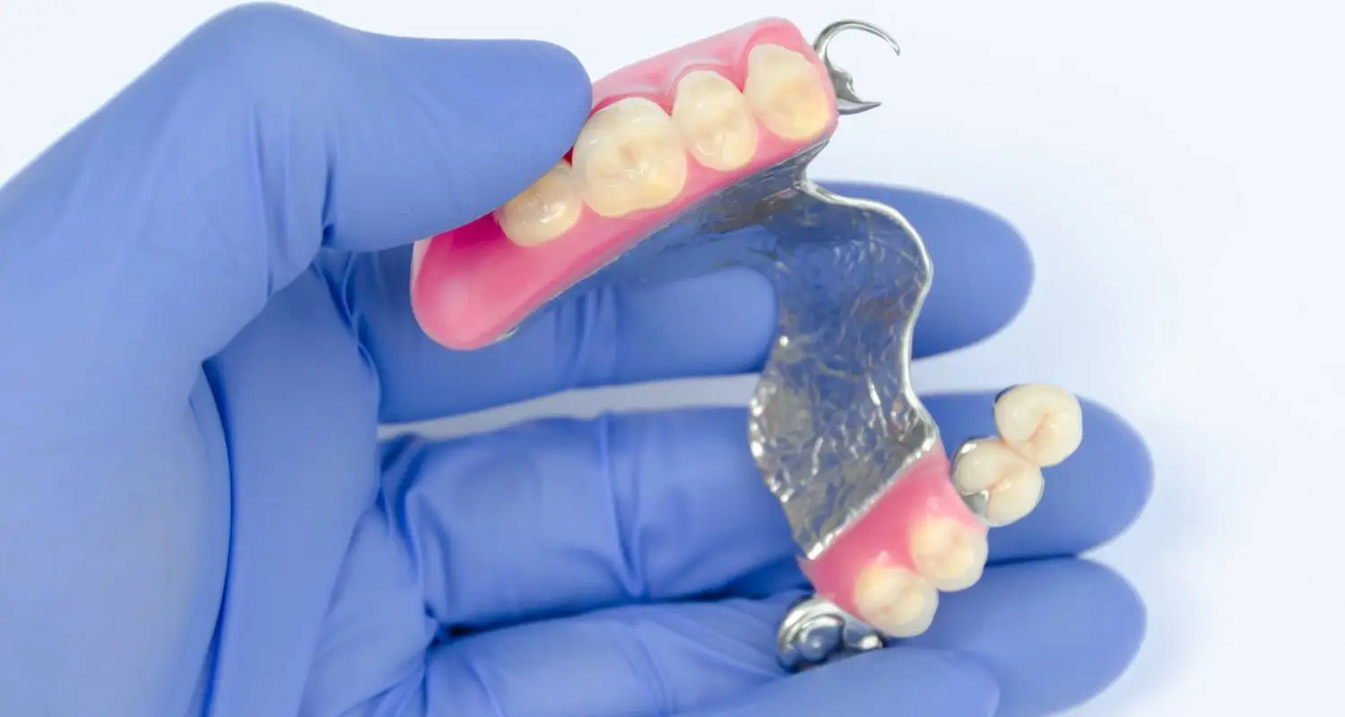 Gloved hand holding a chrome partial denture with metal clasps and pink acrylic base