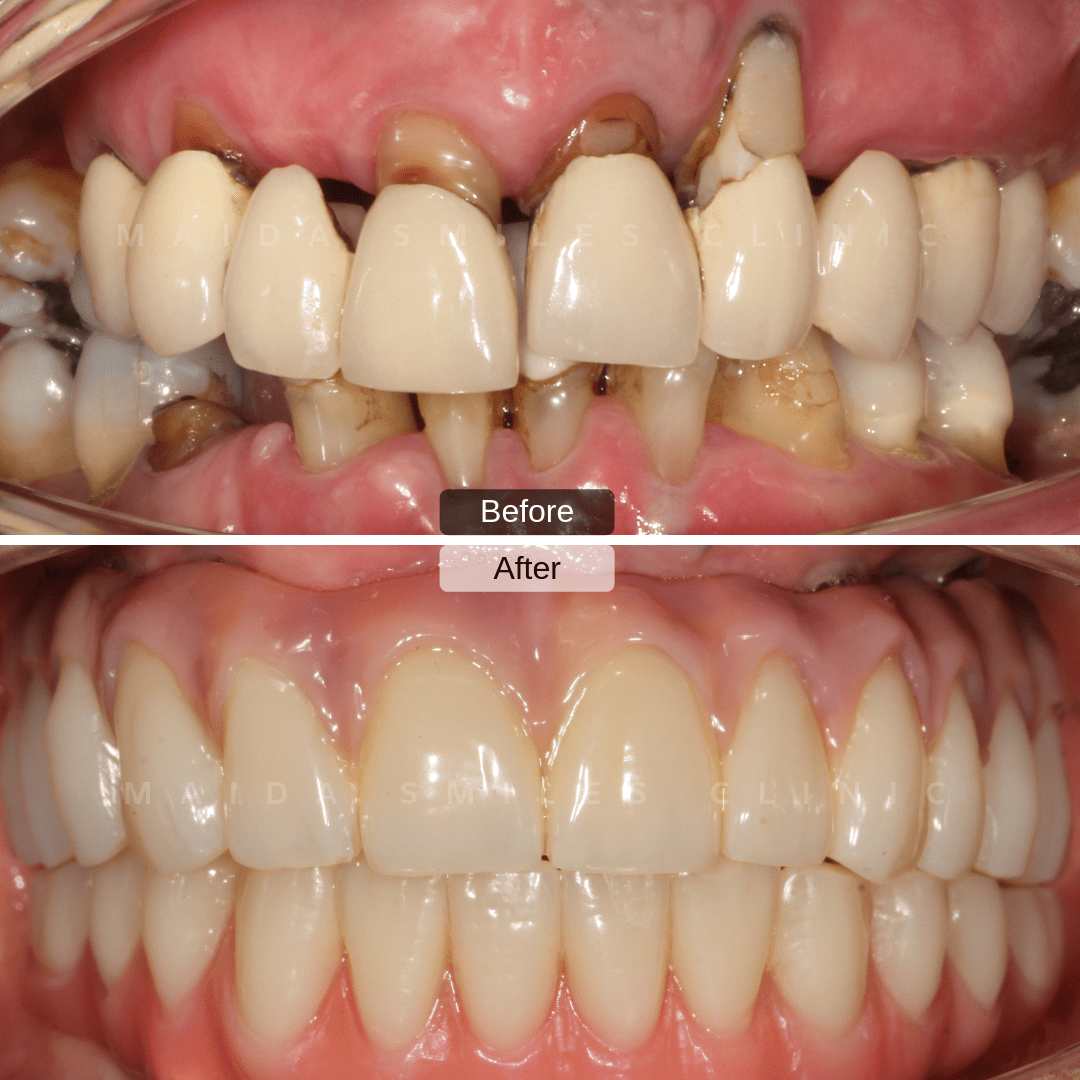 Cosmetic dentistry consultation at Maida Smiles