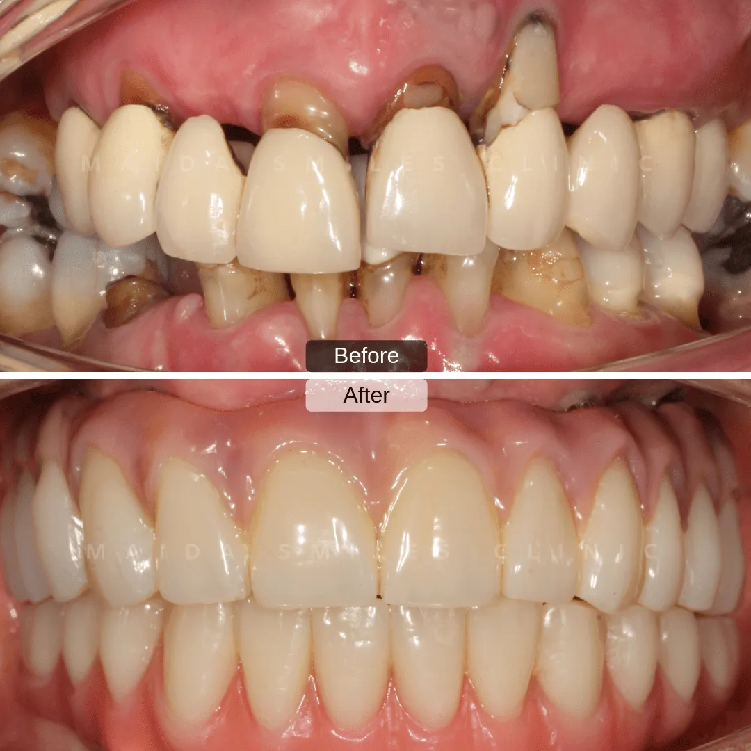 Cosmetic dentistry consultation at Maida Smiles