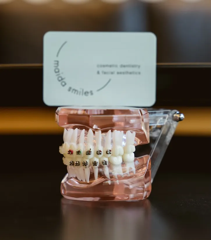 Dental implant procedure photo at Maida Smiles Dental Clinic