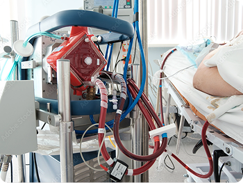 Extracorporeal membrane oxygenation machine connected to a patient's hospital bed.