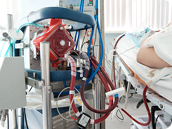 Patient undergoing dialysis treatment hooked to a dialysis machine in a hospital room.