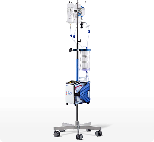 Patient's arm connected to heart-lung machine tubes in a medical setting.
