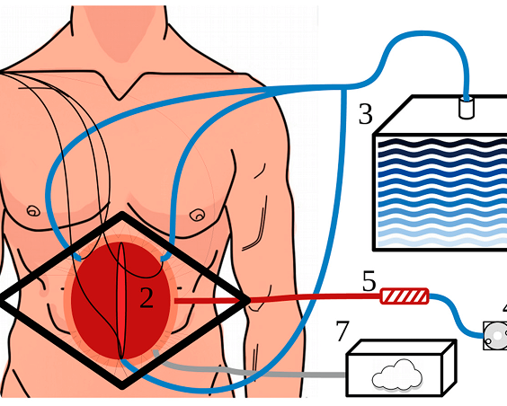 Diagram showing a device connected to a human torso with tubes leading to water and cloud-like containers.