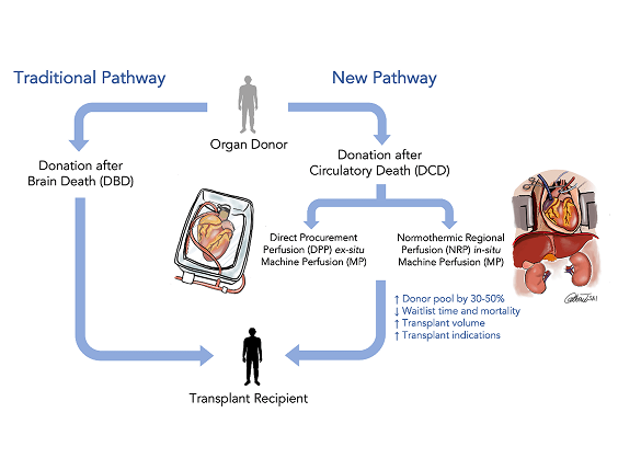 Diagram comparing traditional and new organ donation pathways with heart images and donor, recipient icons.