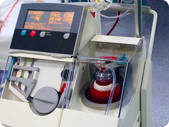 Hospital patient connected to an (ECMO) machine with tubes and medical equipment.