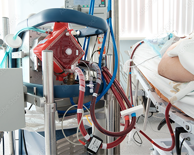 Close-up of a dialysis machine connected to a patient lying in a hospital bed.