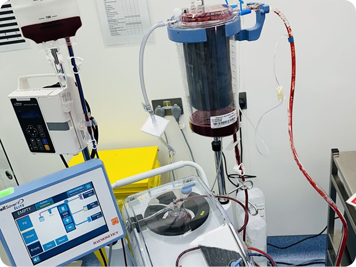 Three healthcare workers in scrubs and masks operate heart-lung machine in a medical setting.
