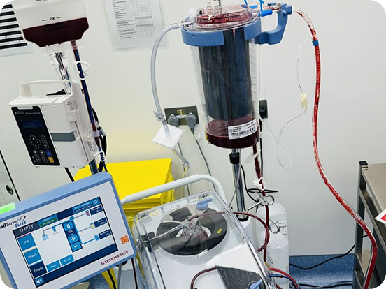 Hospital patient connected to an (ECMO) machine with tubes and medical equipment.