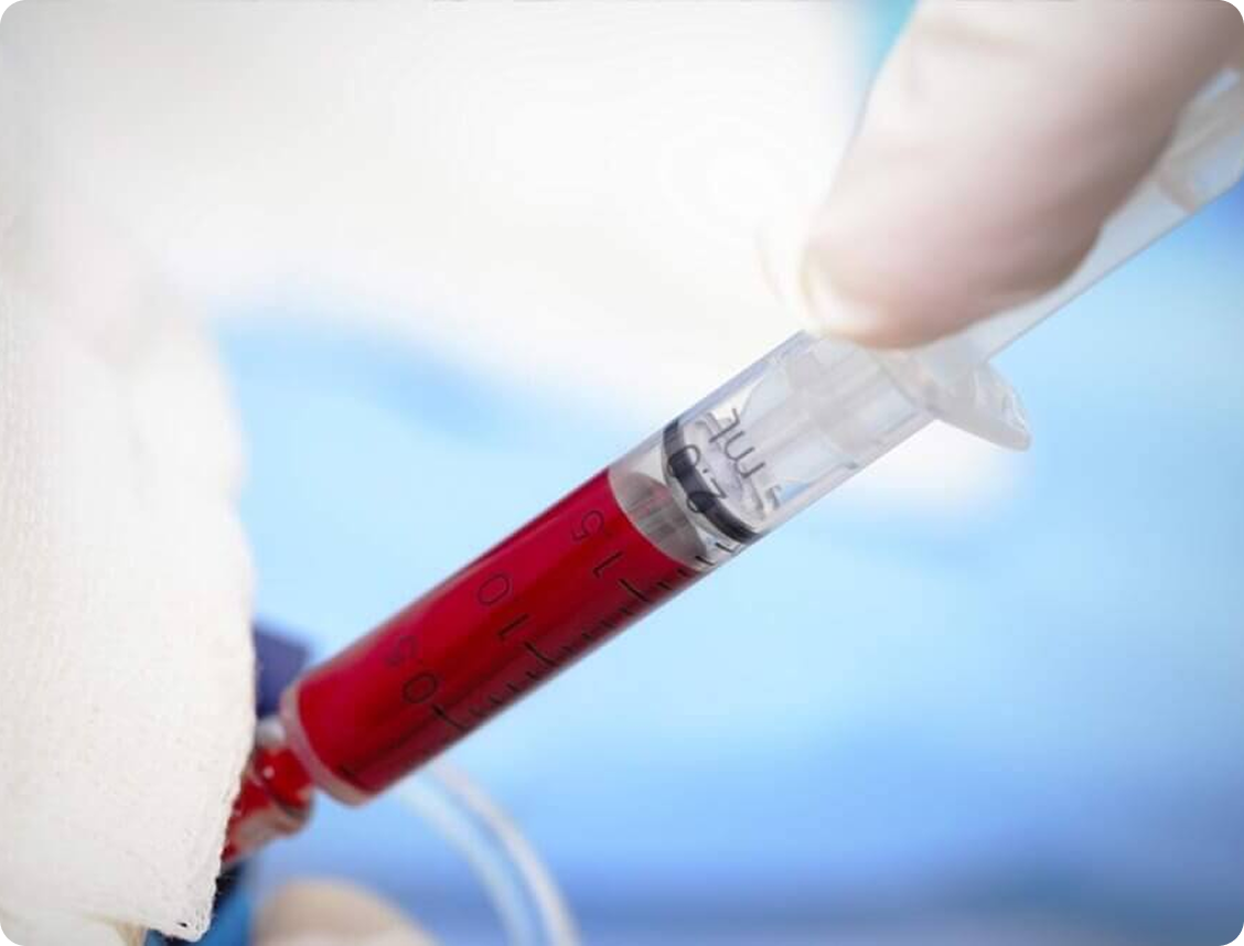 Gloved hand holding syringe filled with red liquid against a blurred blue and white background.