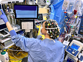 Patient's arm connected to heart-lung machine tubes in a medical setting.