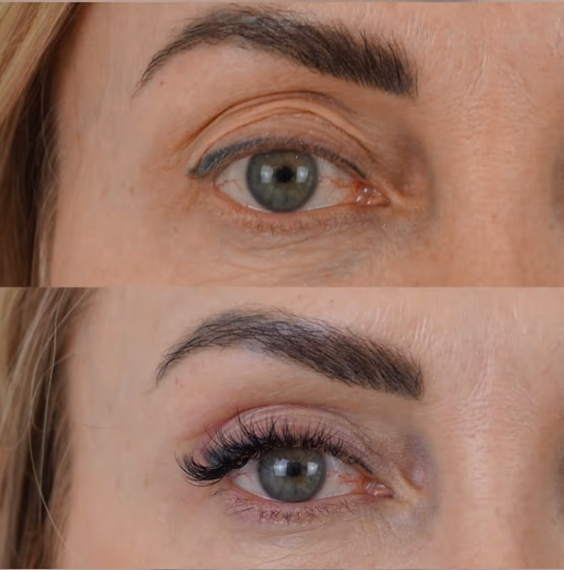 TF Plastic Surgery accompanies you on your journey to a self-confident self – with the most modern methods, individual consultation and the highest medical standards.