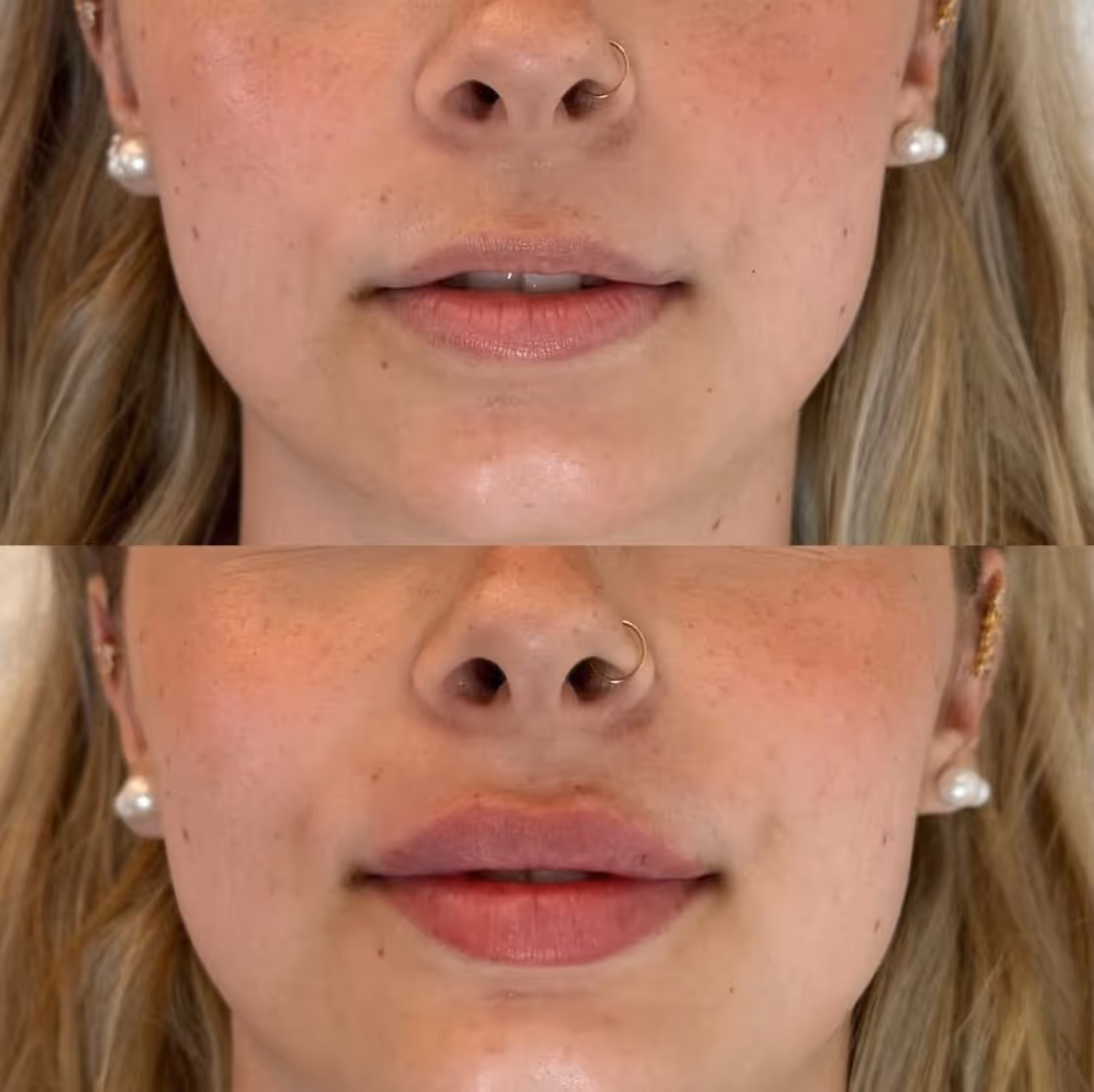 TF Plastic Surgery accompanies you on your journey to a self-confident self – with the most modern methods, individual consultation and the highest medical standards.