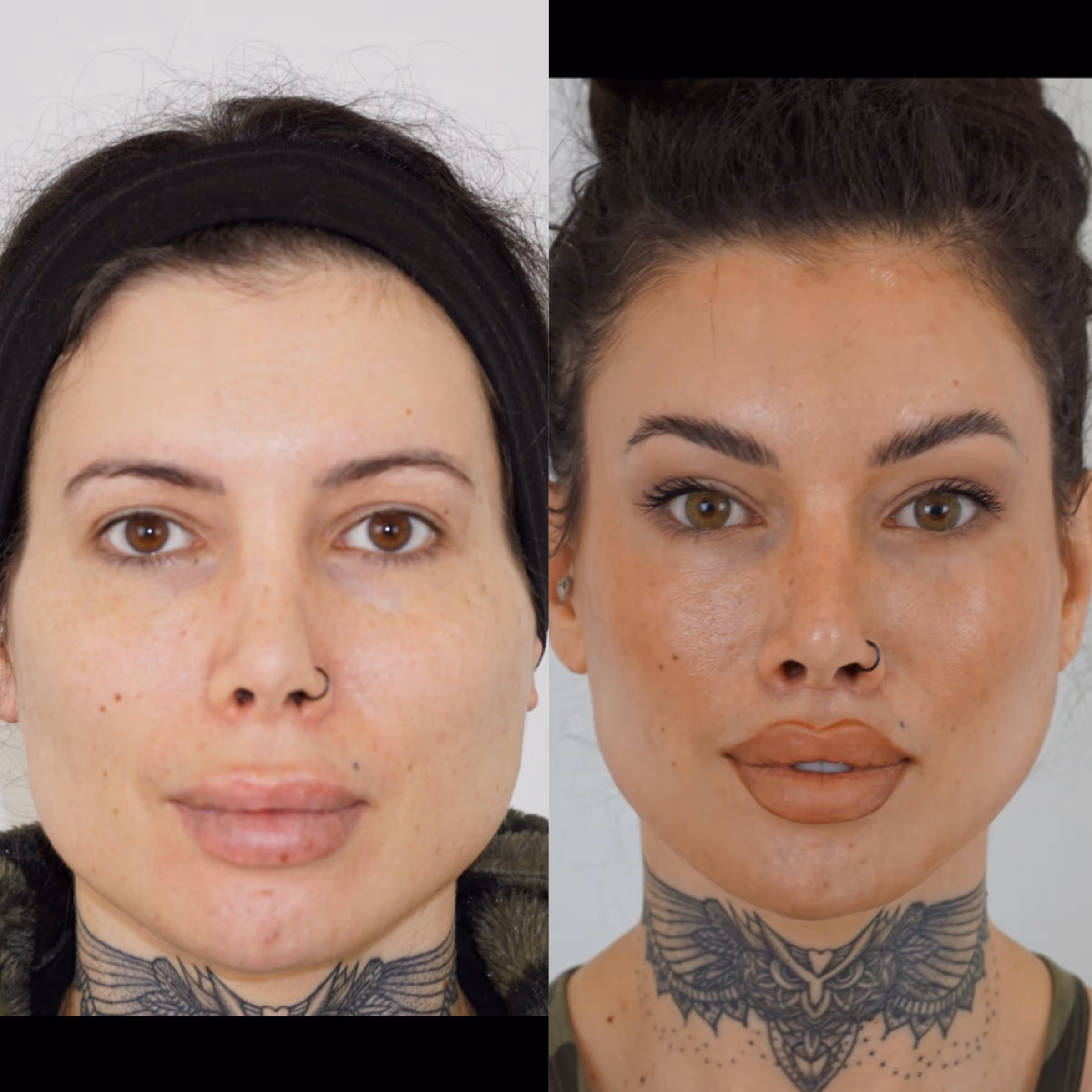 TF Plastic Surgery accompanies you on your journey to a self-confident self – with the most modern methods, individual consultation and the highest medical standards.