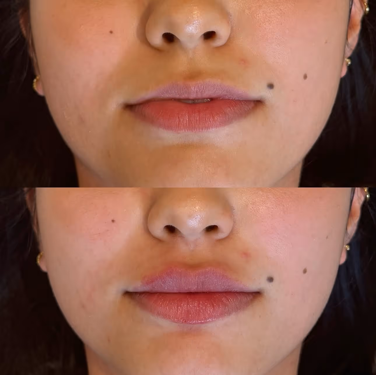 TF Plastic Surgery accompanies you on your journey to a self-confident self – with the most modern methods, individual consultation and the highest medical standards.