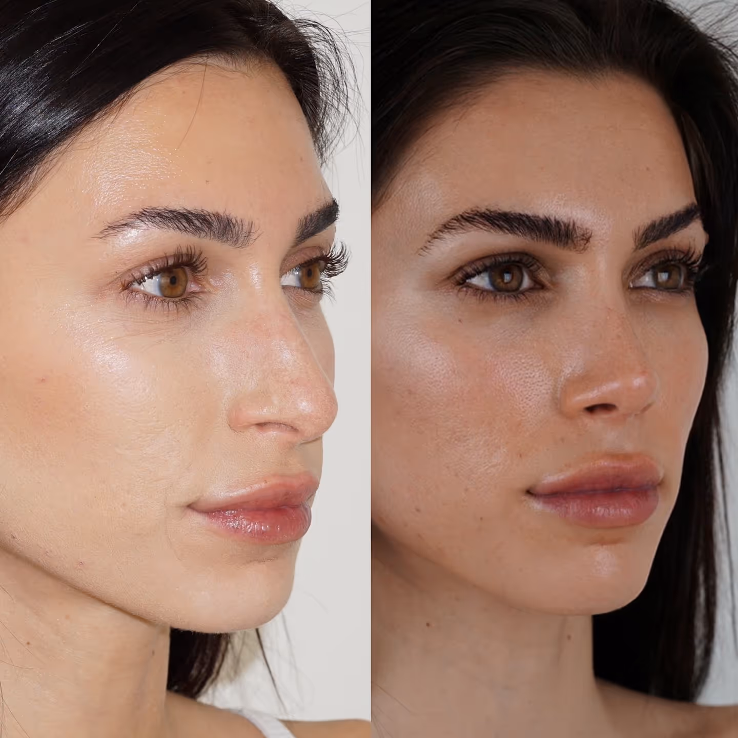 TF Plastic Surgery accompanies you on your journey to a self-confident self – with the most modern methods, individual consultation and the highest medical standards.