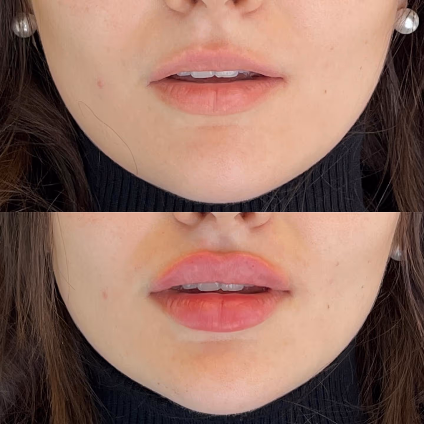 TF Plastic Surgery accompanies you on your journey to a self-confident self – with the most modern methods, individual consultation and the highest medical standards.