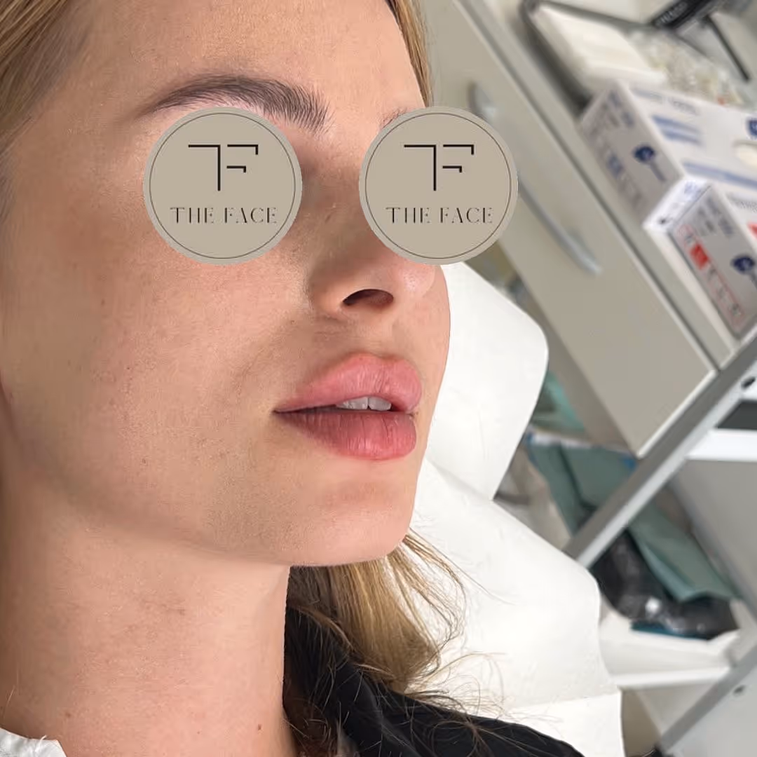 TF Plastic Surgery accompanies you on your journey to a self-confident self – with the most modern methods, individual consultation and the highest medical standards.