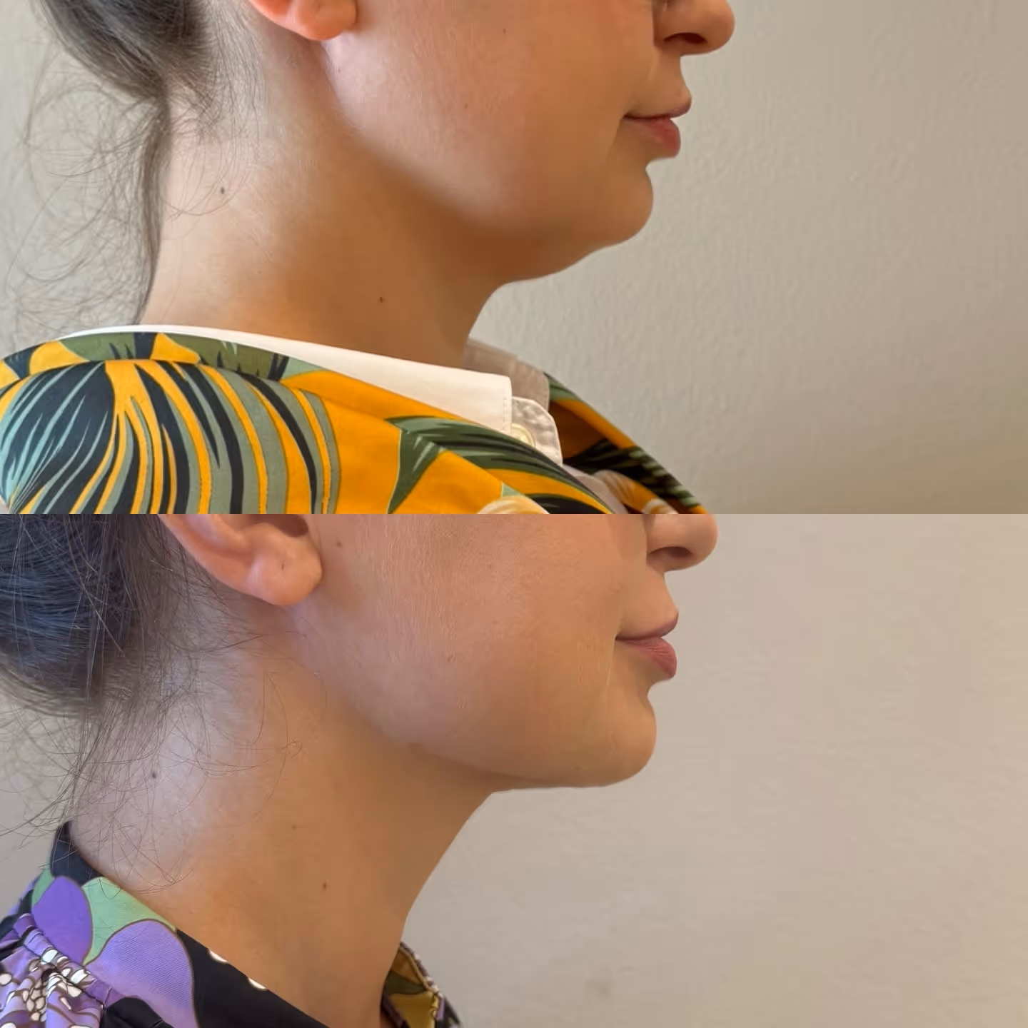 TF Plastic Surgery accompanies you on your journey to a self-confident self – with the most modern methods, individual consultation and the highest medical standards.