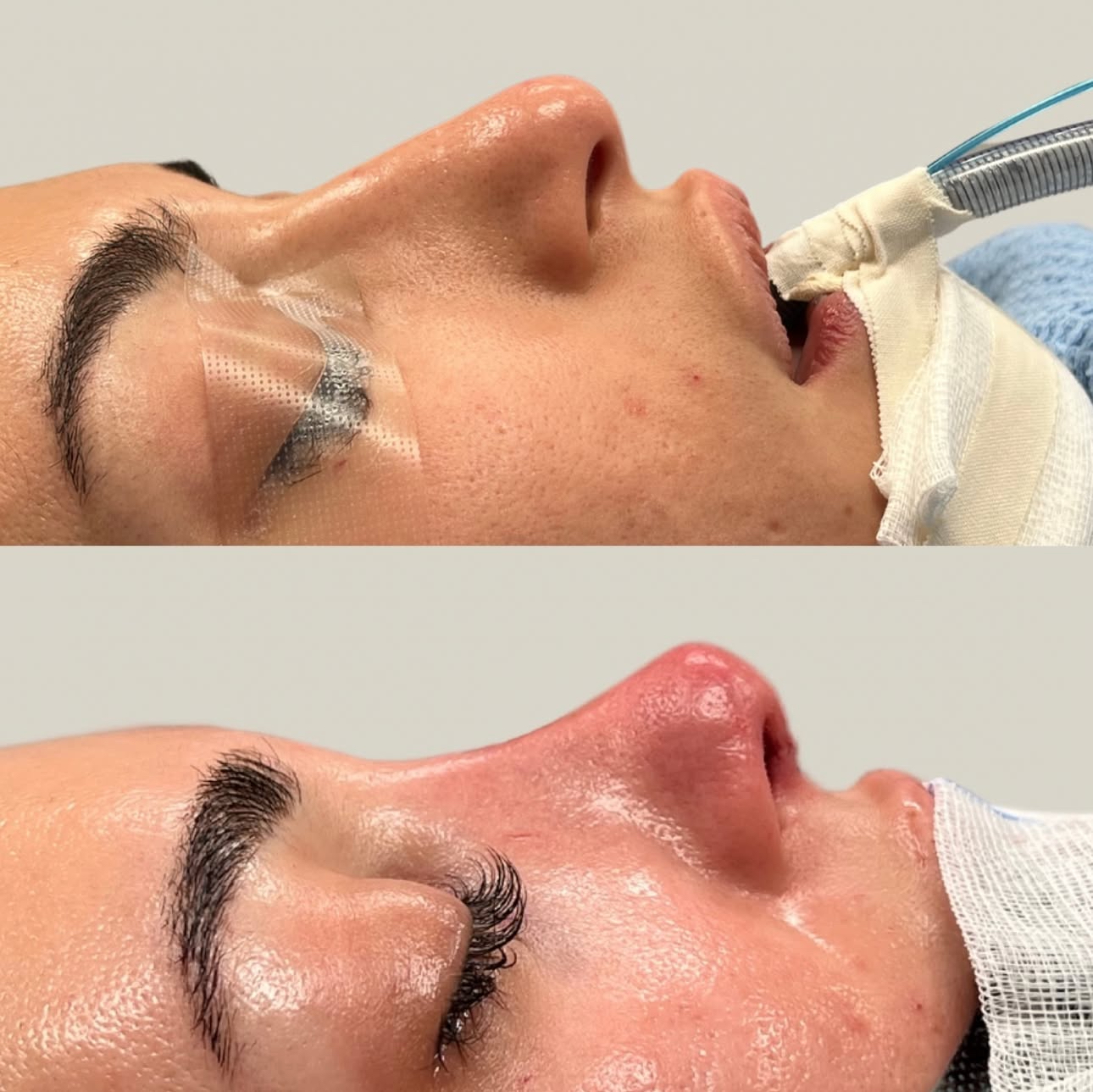 nasenkorrektur-dr.wenny