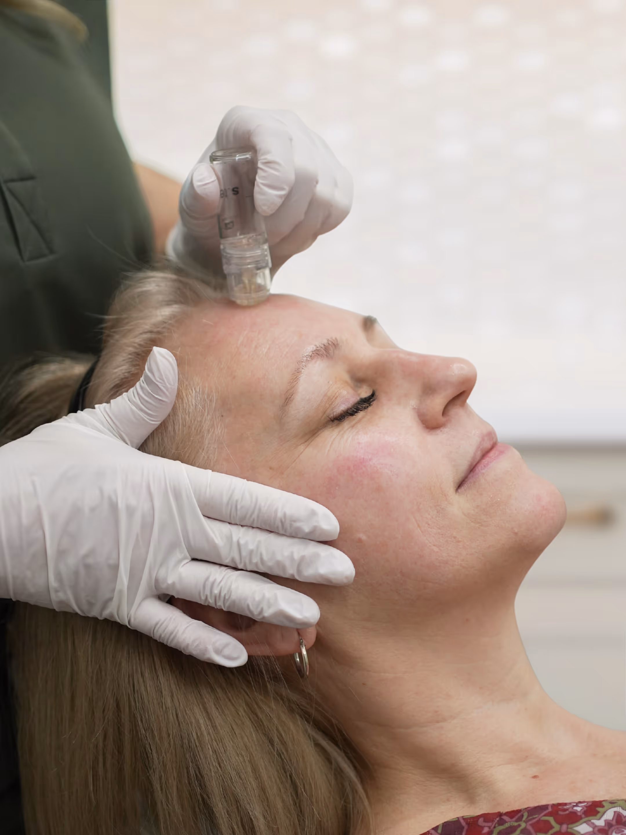 Injectable Mesotherapy