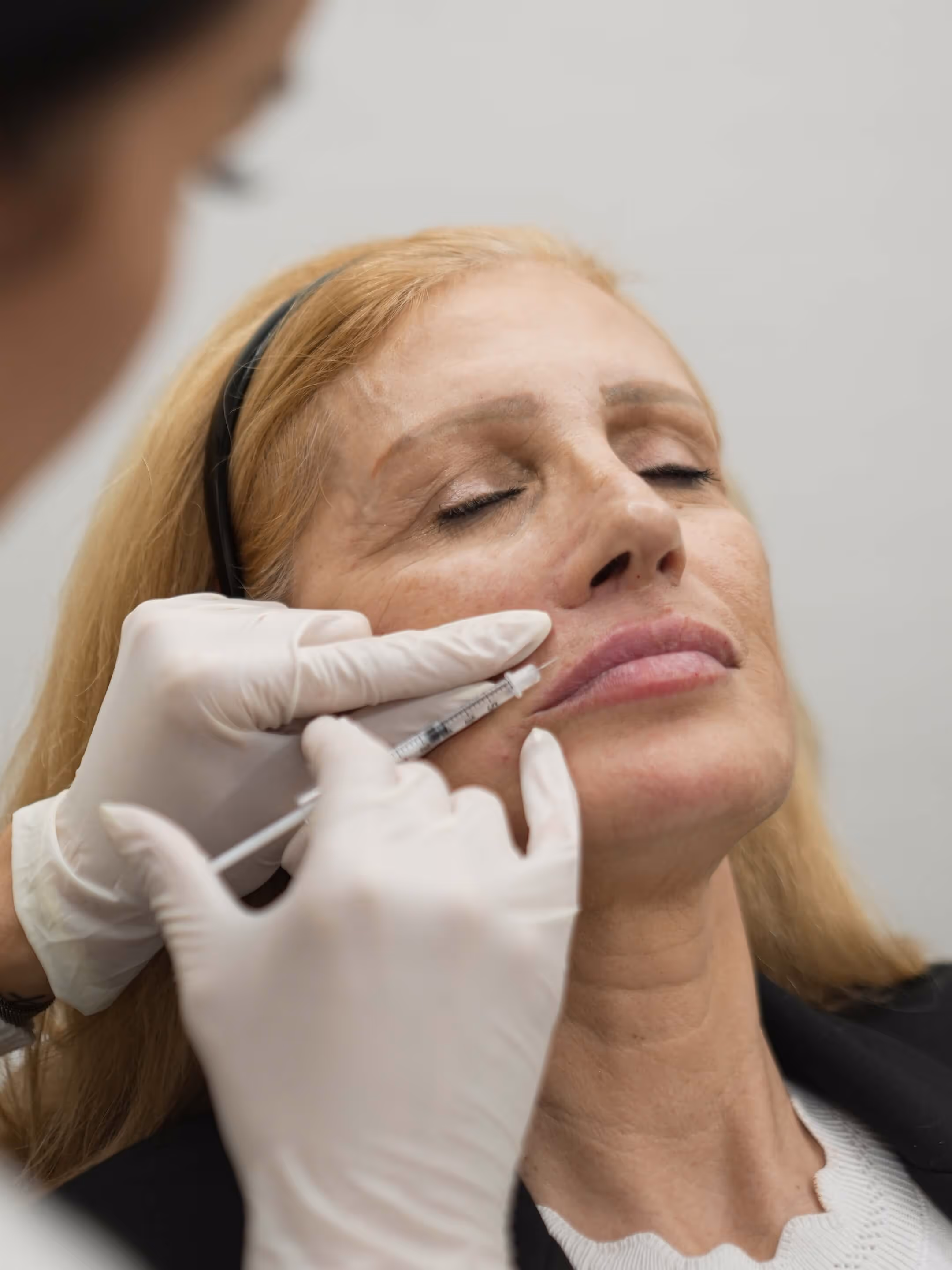 Full Face Transformation