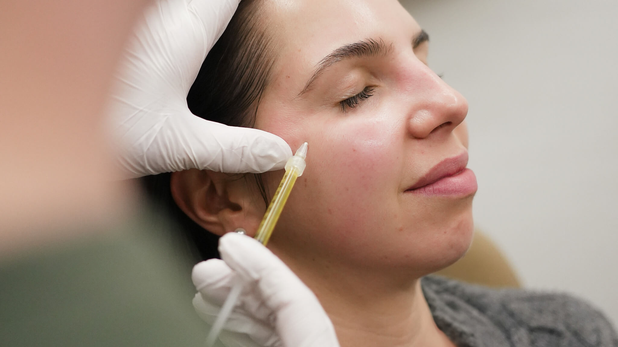 A Complete Guide to PRP & PRF Facial Rejuvenation in Edmonton