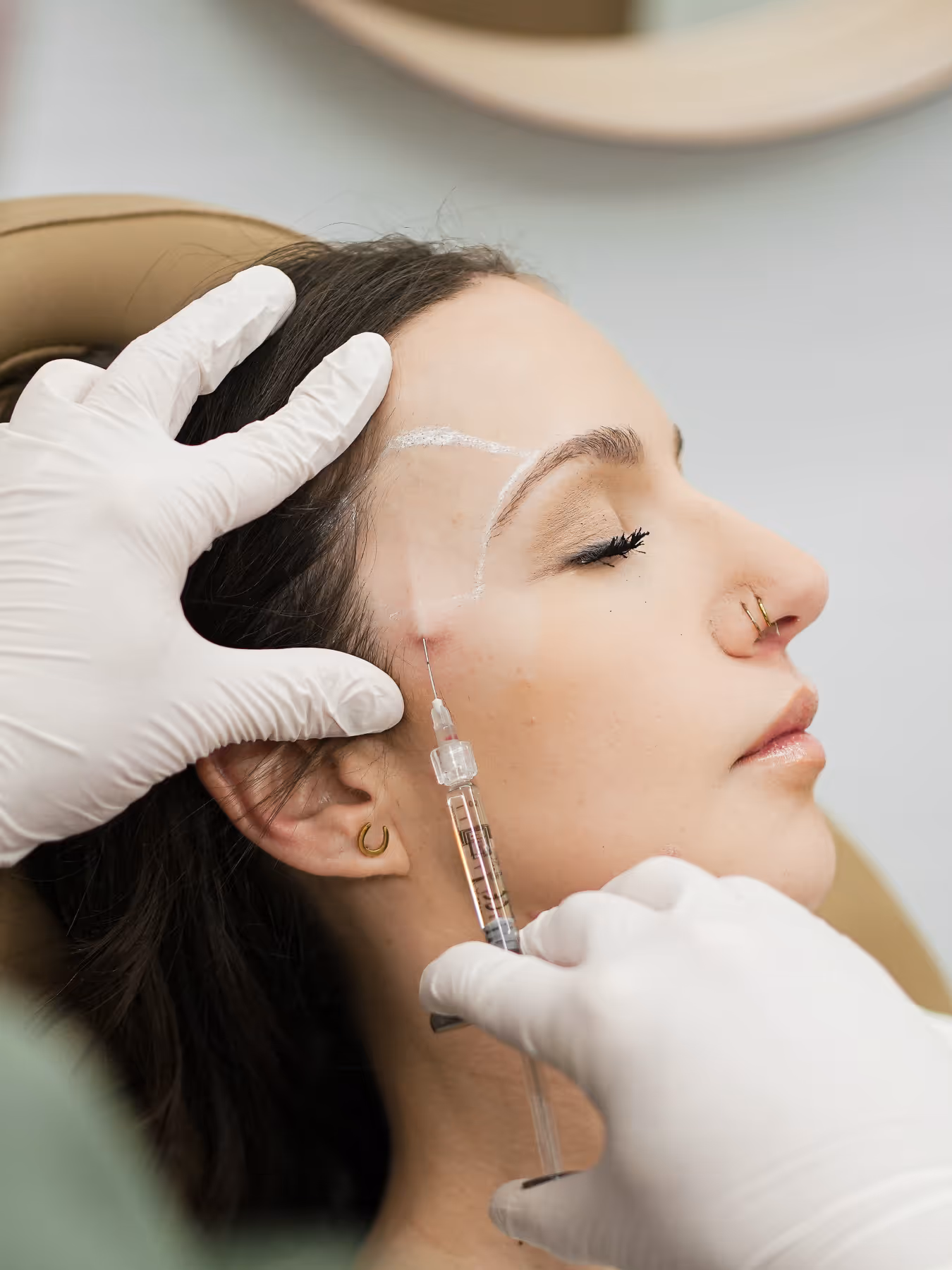 Botox vs Dermal Fillers: Which Treatment Is Right for You in Edmonton?