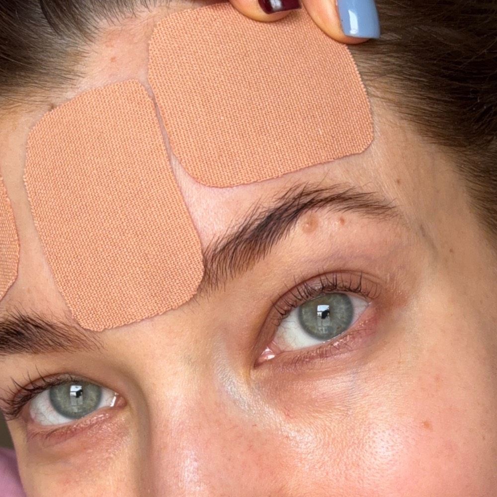 Närbild på ansikte med "face tape", alltså tejp som tejpas i ansiktet för att motverka ansiktsrörelser och på så sätt kunna förhindra rynkbildning, bilden är en närbild på ett ansikte där man ser ögon och panna samt tre tejpbitar i brunt