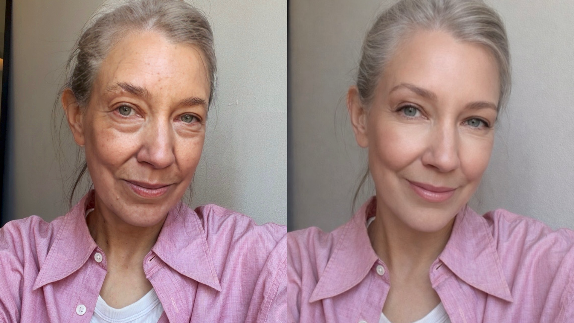 Kollage som visar Lina Livian åldrad med rynkor och efter ett potentiellt facelift, bilden är AI-genererad
