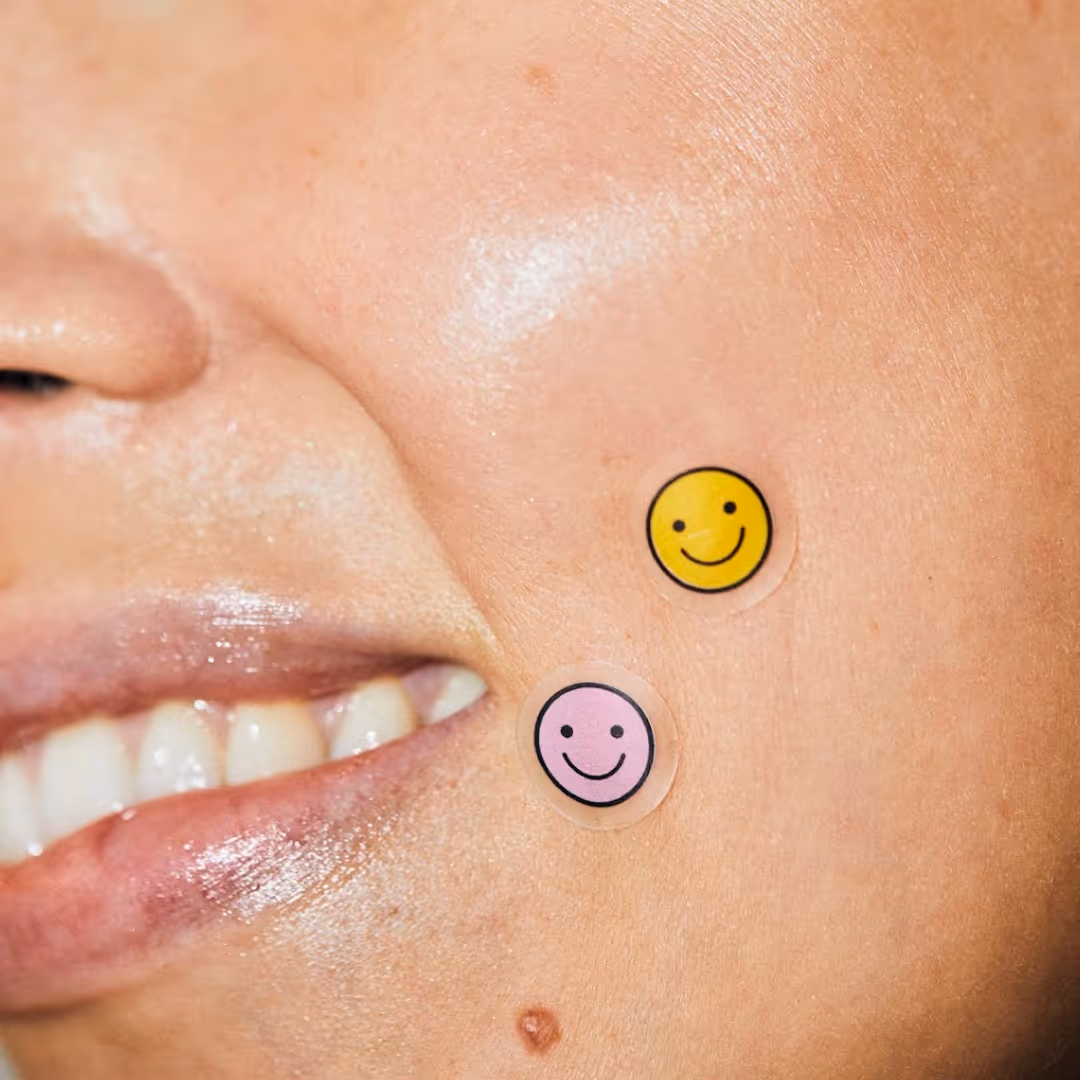 Bli av med en finne snabbt med pimple patches: Lina Livian har pimple patches i ansiktet