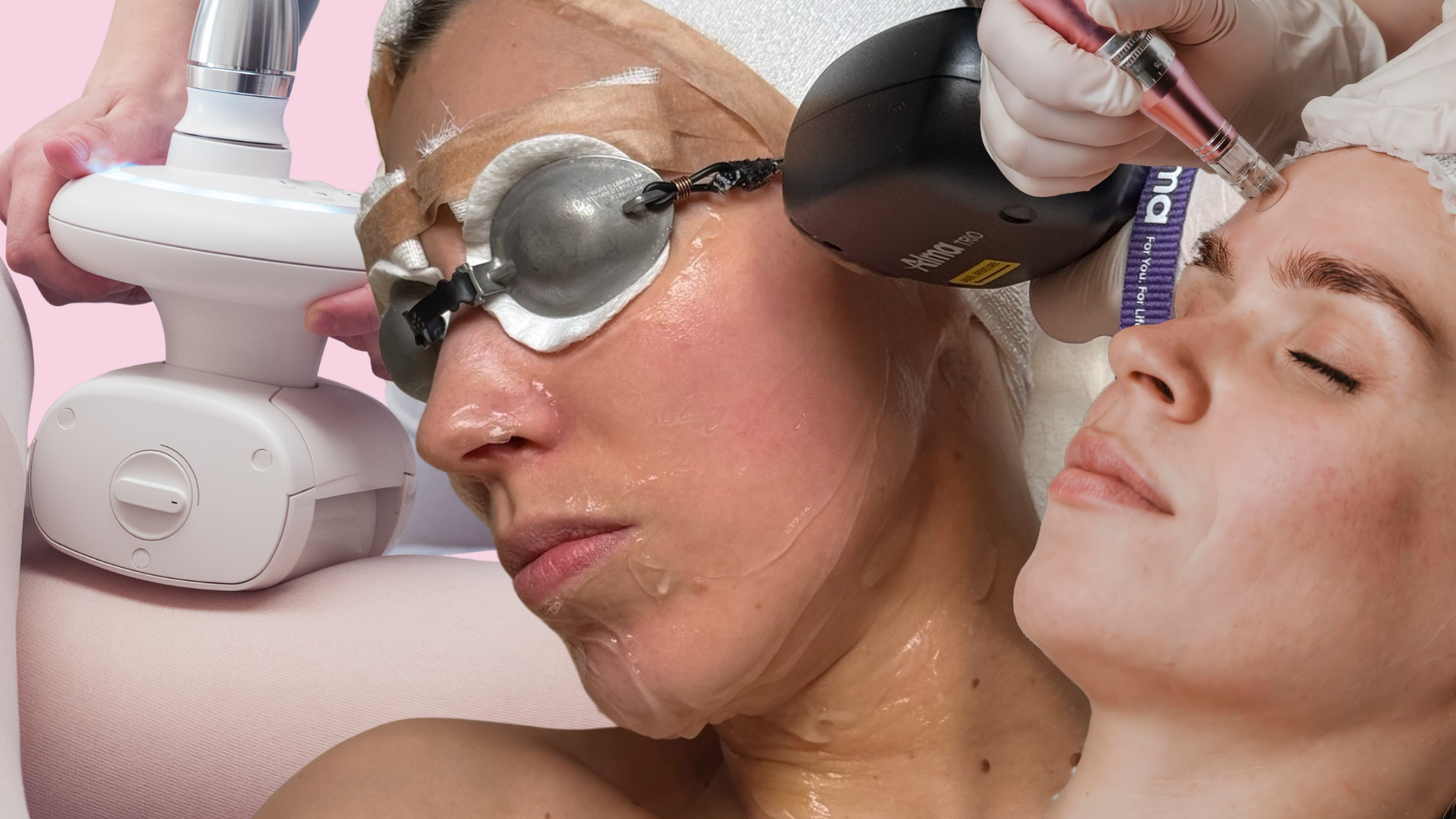 Laser, IPL, HIFU, EMS, microneedling, kemisk peeling, vilken salongsbehandling gör vad?