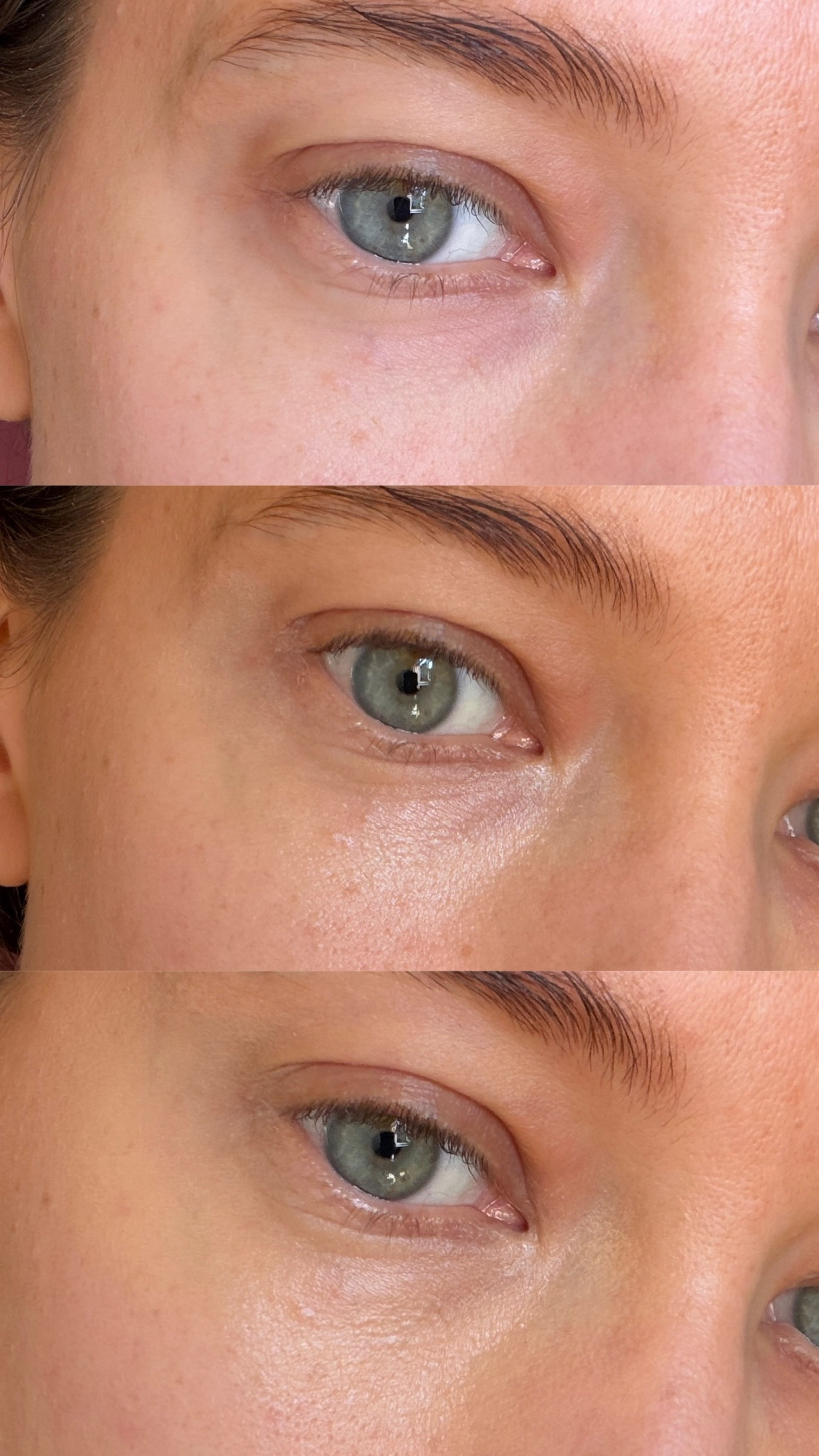 Resultat caia dewy drops serum concealer