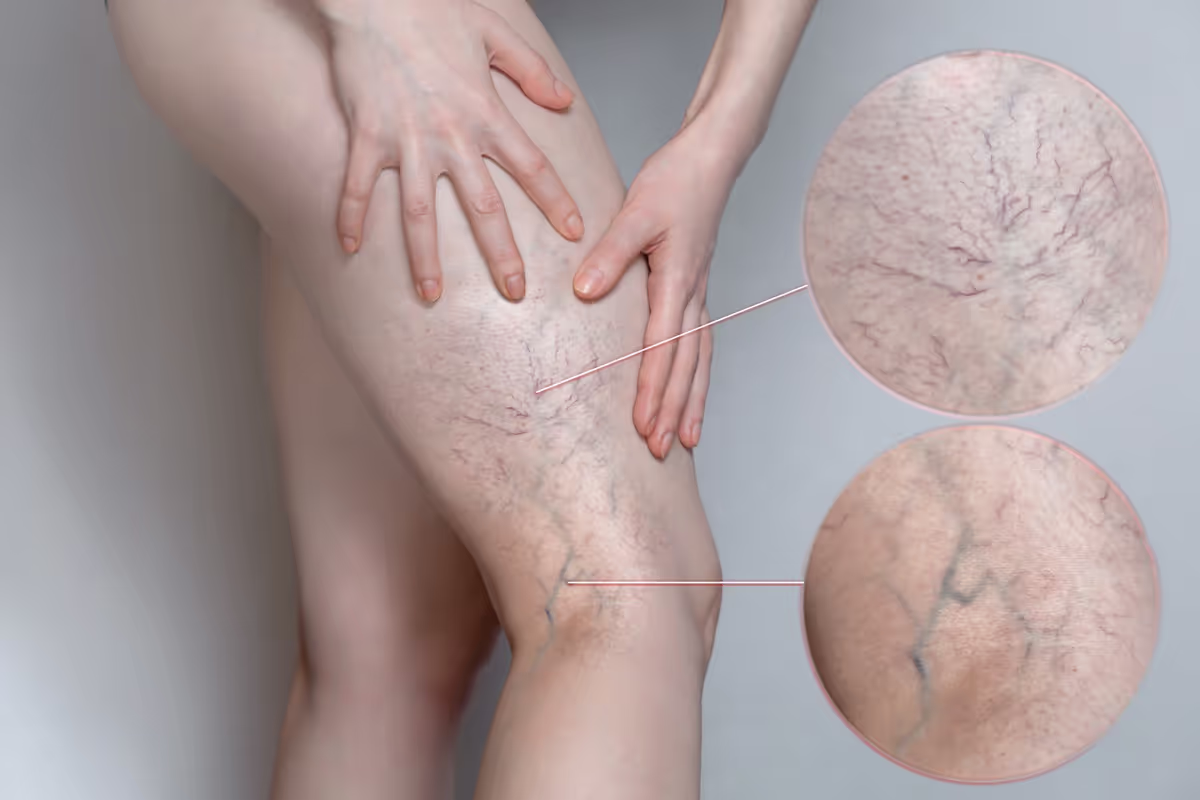 Dealing with knee pain without surgery
