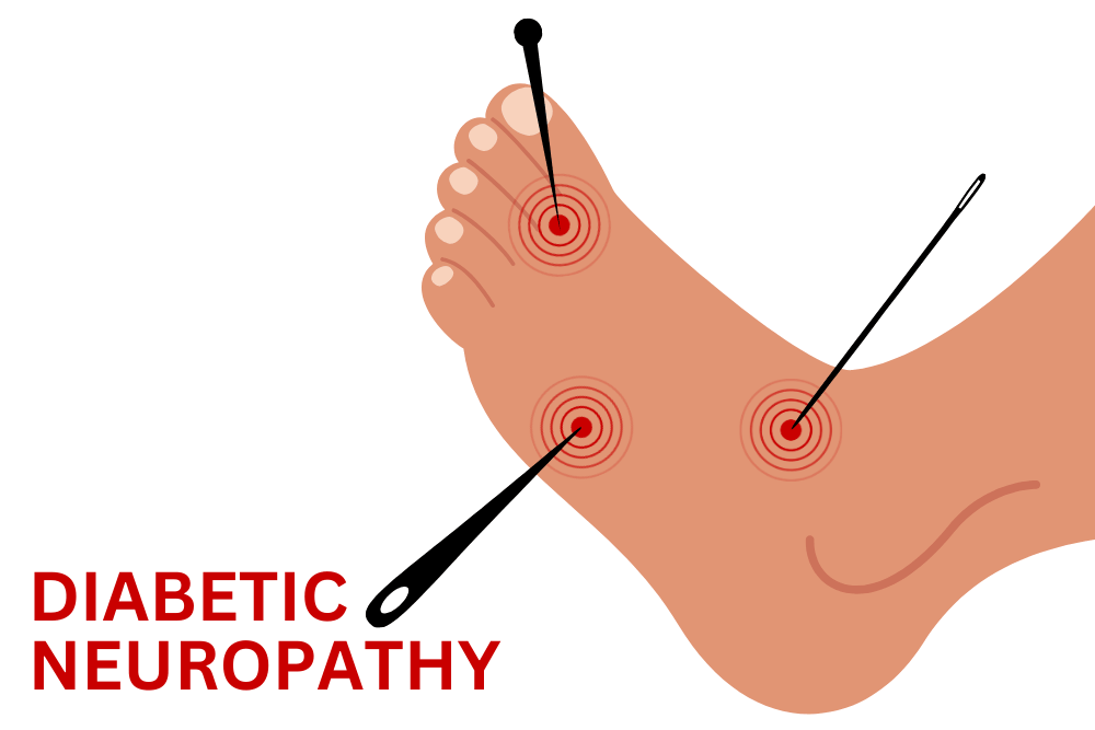 Best Physiotherapy Clinic in Gurgaon for Diabetic Neuropathy