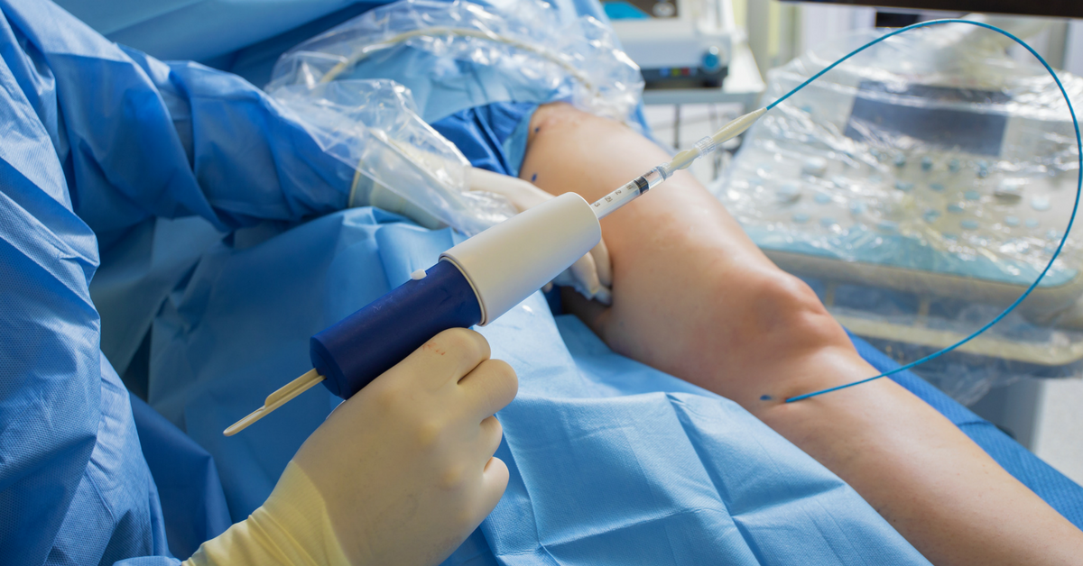 Optimizing Your Field Inventory Asset Utilization (Without Losing Sales)