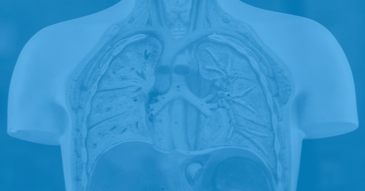 You Want to Increase Asset Utilization & Sales—So Do It (Stop Imagining and Take Action, Here Is How)