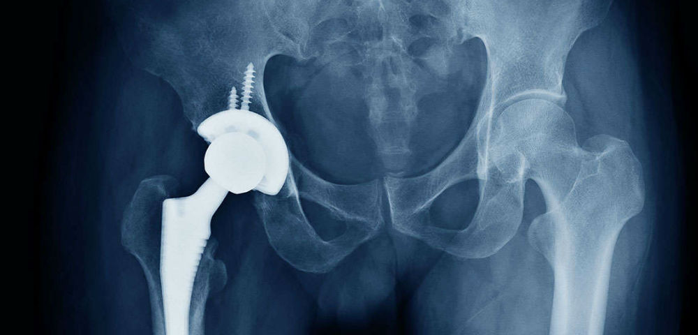 Too Many Disconnected Tools Drive Down Inventory Performance