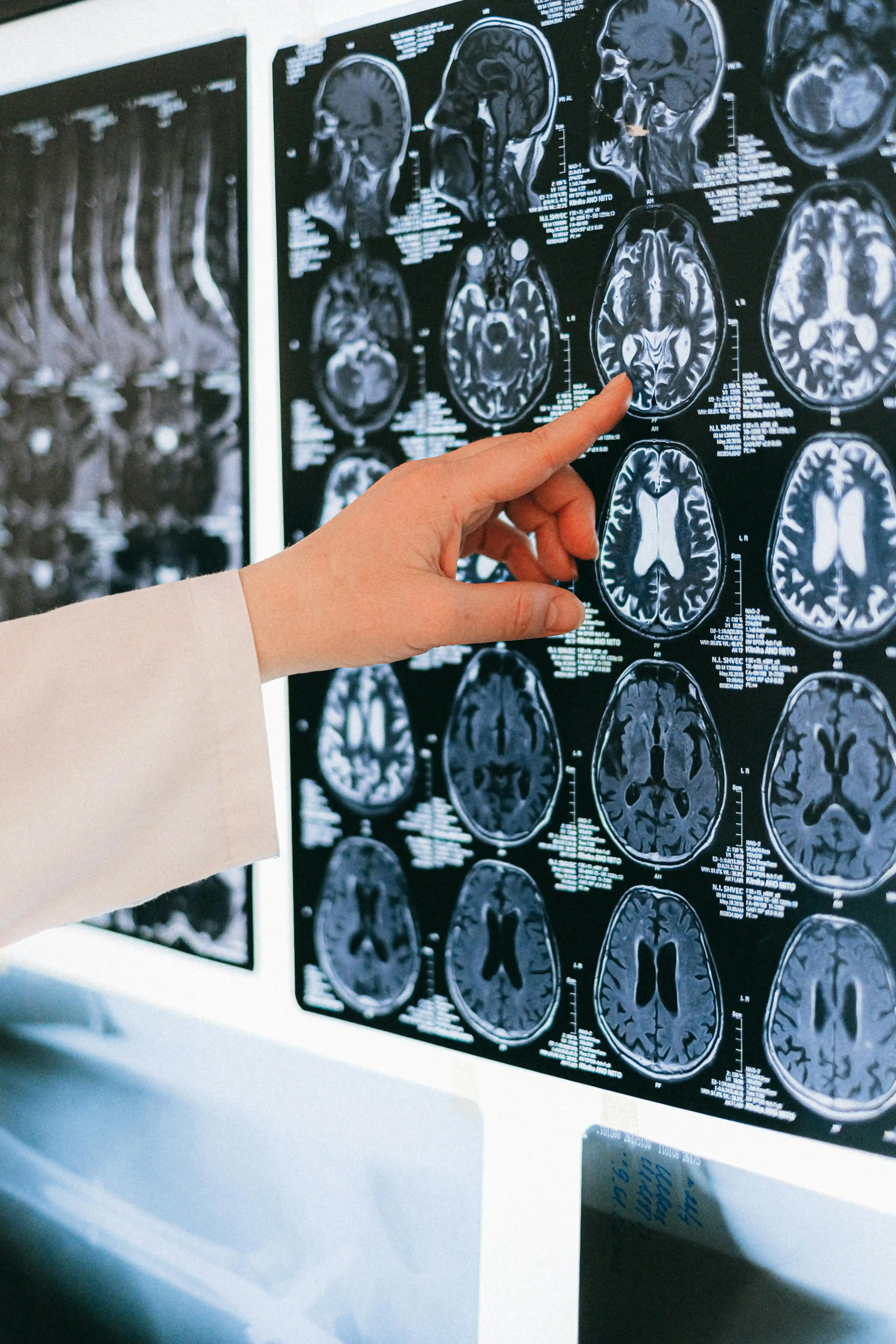 Brain scanner