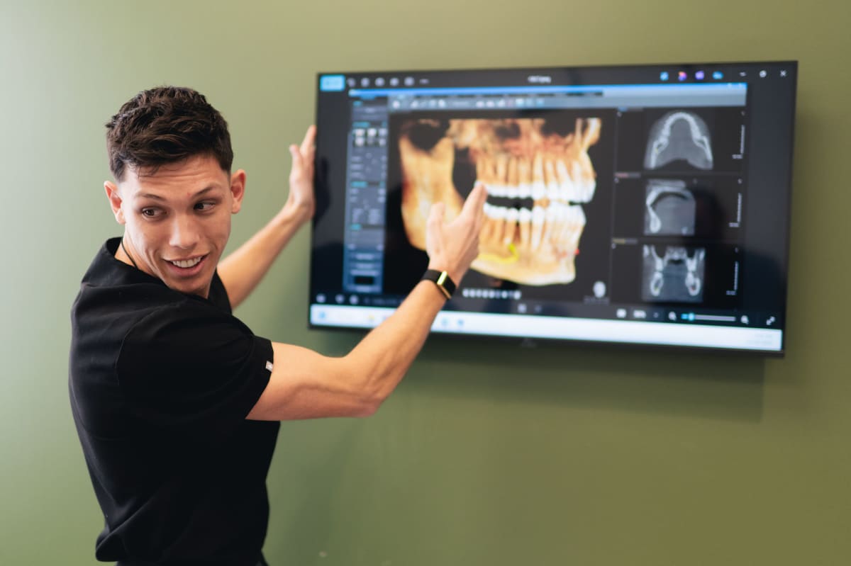 All-on-X dental implants comparison with patient showing smile results and implant structure diagram