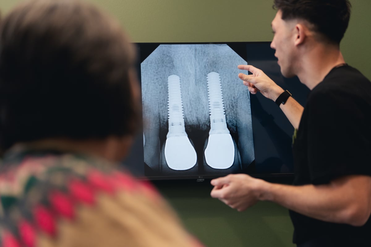 Dentist examining dental X-ray showing implant placement on patient's teeth