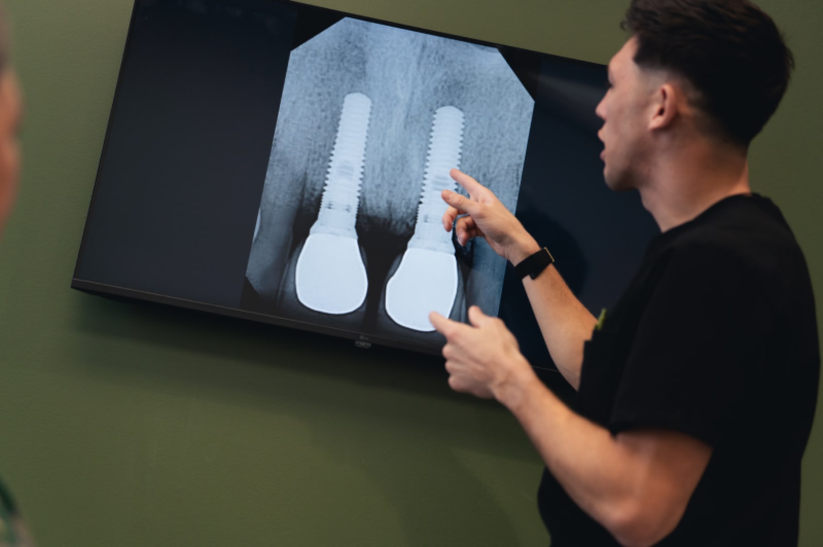 Dentist examining dental X-ray on monitor with patient in treatment chair