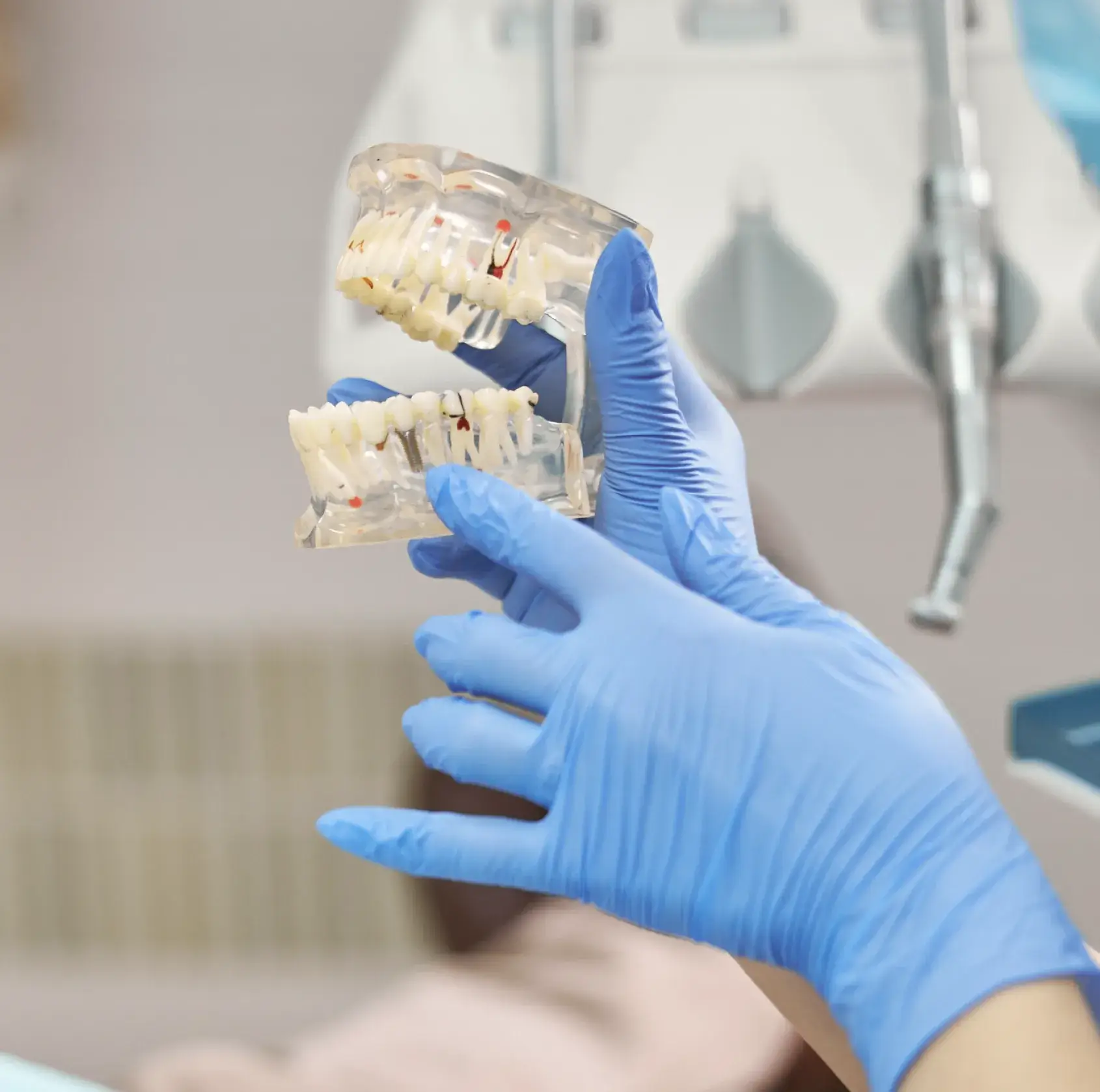 Dental implant consultation with model illustrating tooth replacement options